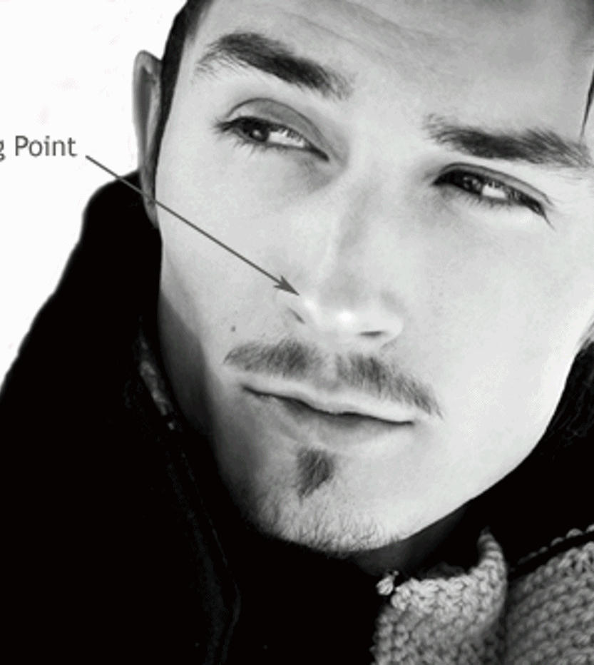 Burun Eti Büyümesi (Konka Hipertrofisi)