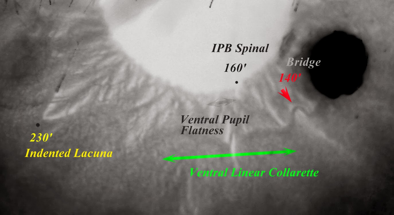 Modern & Multidimensional Iridology The Combination & Correlation on Multidimensional Iris