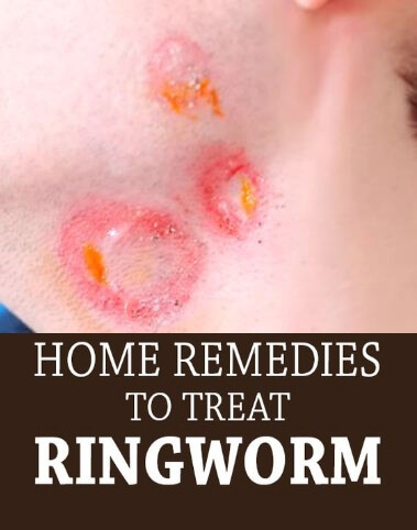 Natural Remedy For Worms In Dogs And Cats Natural Remedy For Worms In Dogs And Cats