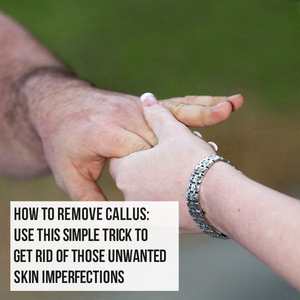 How to Remove a Callus A Simple Trick • Style Notes 4 Guys