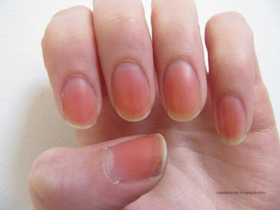 http://2.bp.blogspot.com/-wFZEc4REzCg/TohPCBuUpYI/AAAAAAAABF0/1BosvQMMW5Q/s1600/Stained+nails.JPG