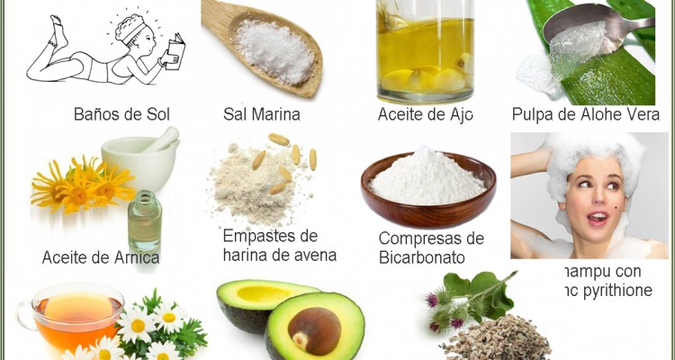 Remedios populares para la psoriasis