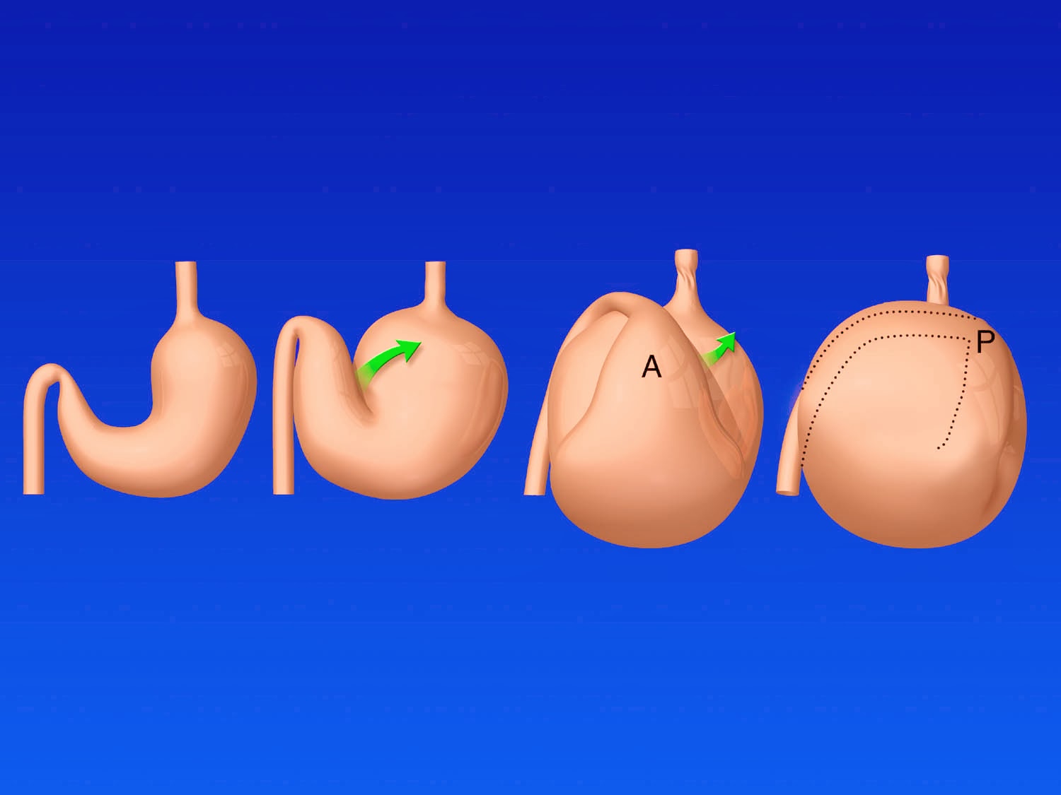 Circle City Veterinary Specialty & Emergency Hospital: As the Stomach Turns
