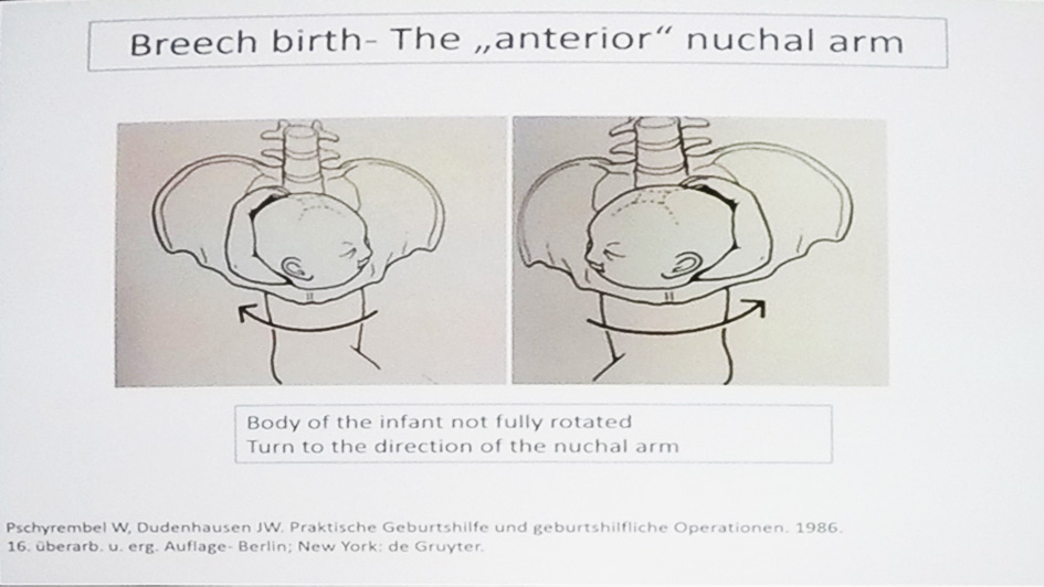 Stand and Deliver Anke Reitter New Insights from Pelvimetric MRI