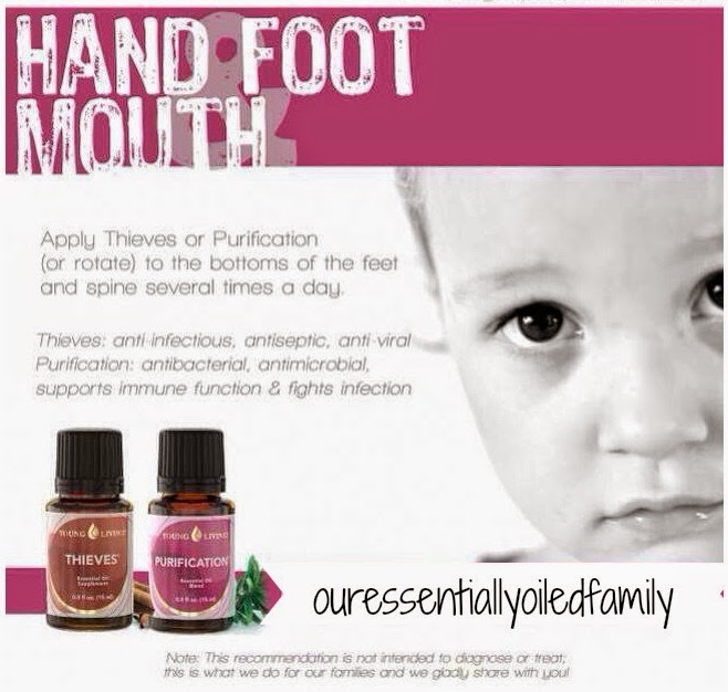 Our Essentially Oiled Family Hand Foot & Mouth Disease