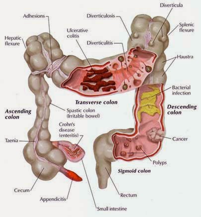 Image result for proses pembersihan usus