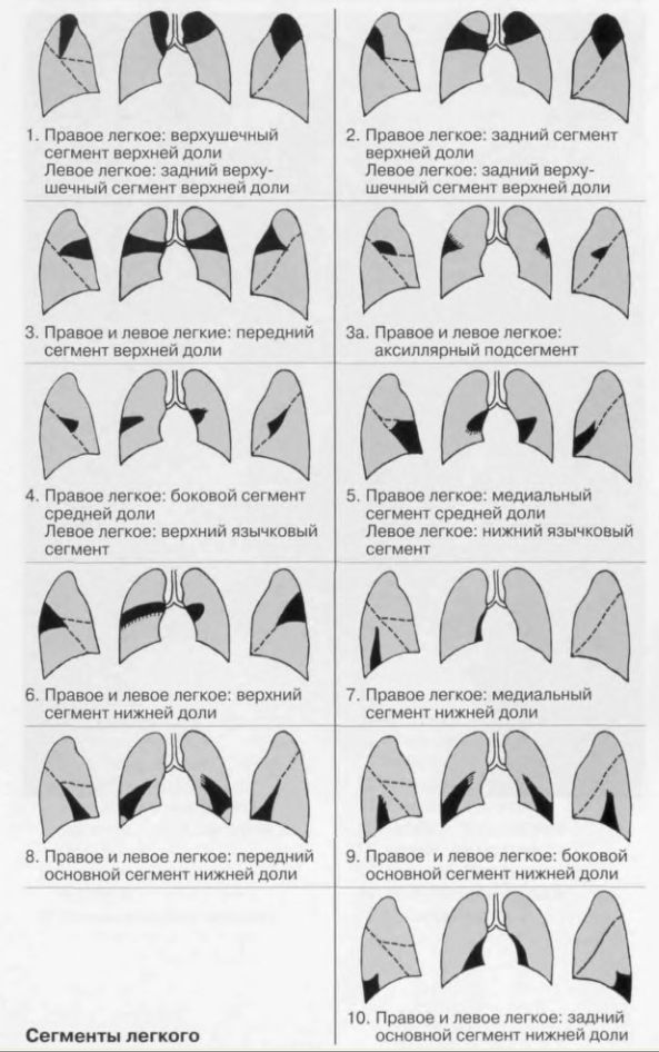 Рентген схема сегменты. Сегментарное строение легких рентген. Сегменты легких рентген схема. Доли и сегменты легкого на рентгенограмме. Сегменты легких на рентгенограмме схема.