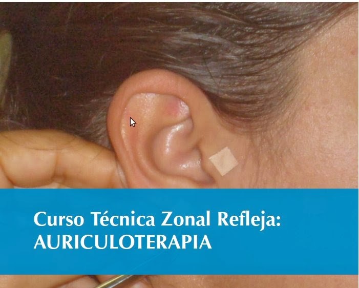 Curso de Auriculoterapia para Enfermería