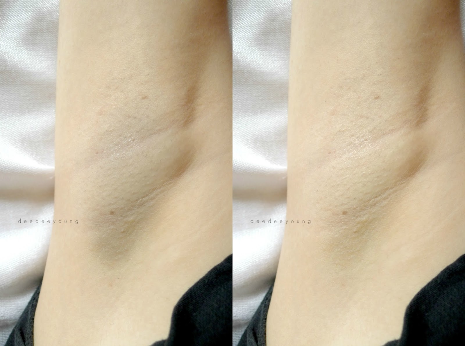 Beauty Blog by Deedee Young Underarm Essentials How I Lighten My