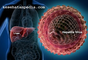 Jenis-jenis penyakit hepatitis