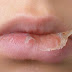 Perawatan untuk Mengatasi Bibir Kering dan Pecah-Pecah dengan Vaseline Lip Therapy