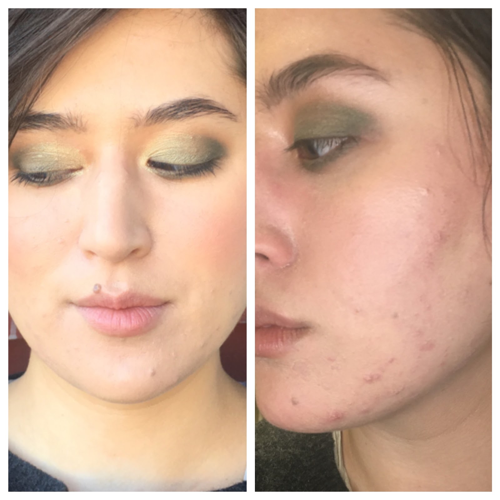 Faceonomics How I Fixed My Dehydrated Skin