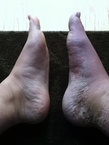 Foot compare