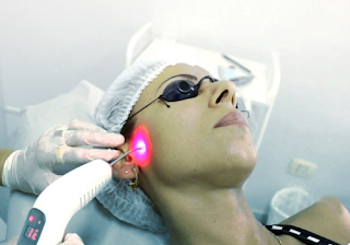Laserterapia na Paralisia Facial