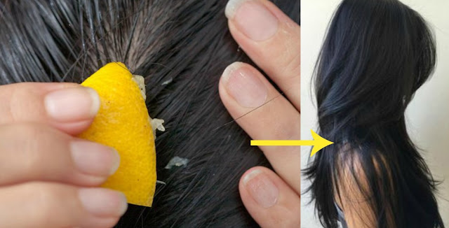 طريقة علاج تساقط الشعر بعصير الليمون