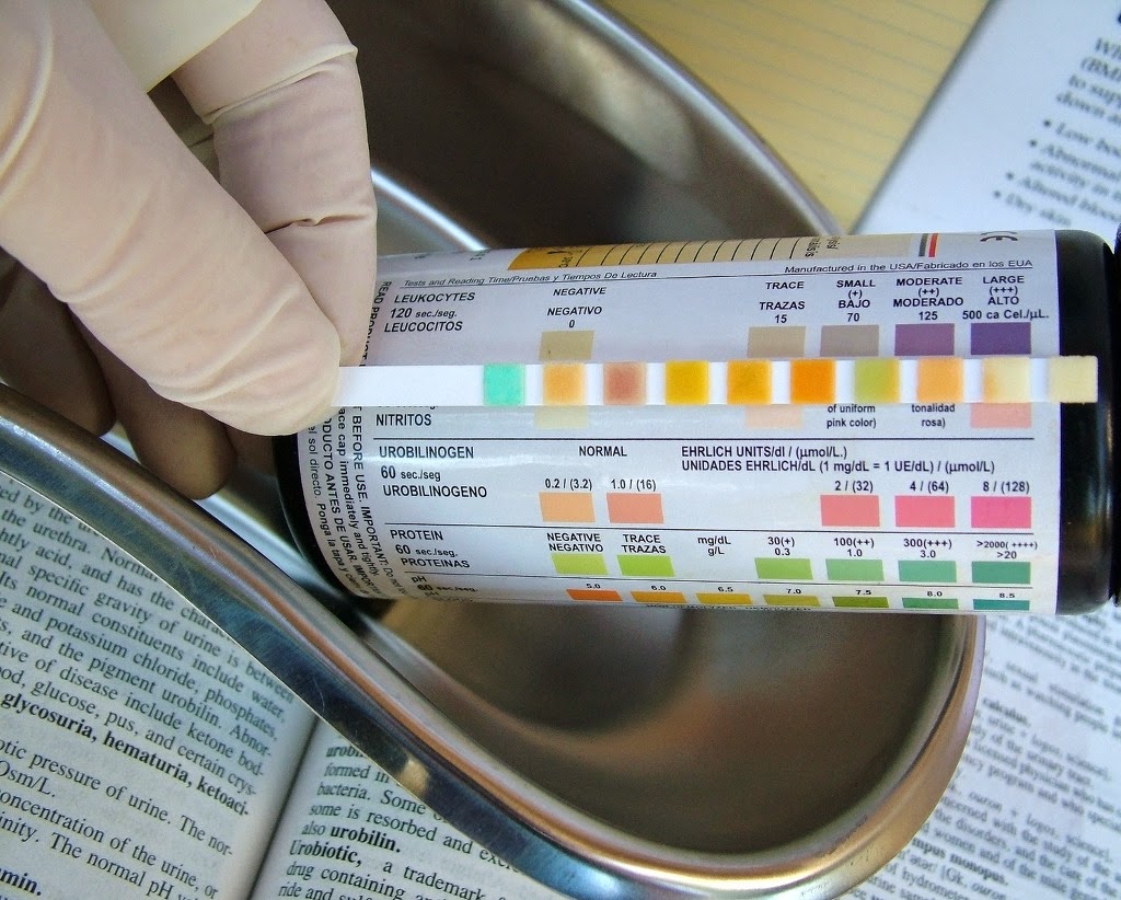 籲洗腎親友護腎　醫院推尿篩檢