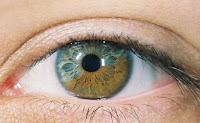 ojo con heterocromía
