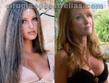 Vicky y stefy xipolitakis antes y despues de adelgazar