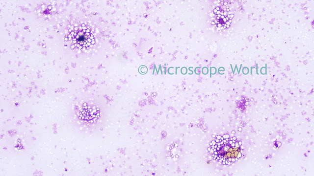Whooping cough bacteria seen under the microscope at 400x.