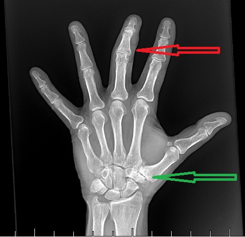 xray vision xray vision