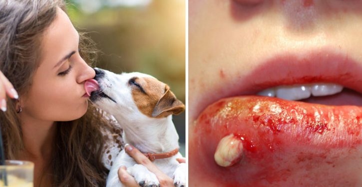 Do Not Let Your Dog Lick You