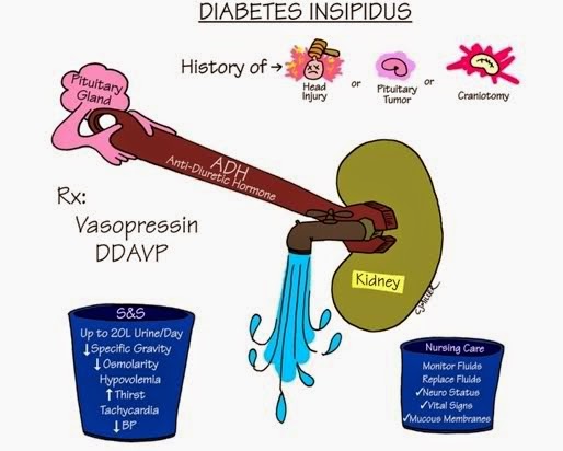 Pengobatan Tradisional Diabetes Insipidus