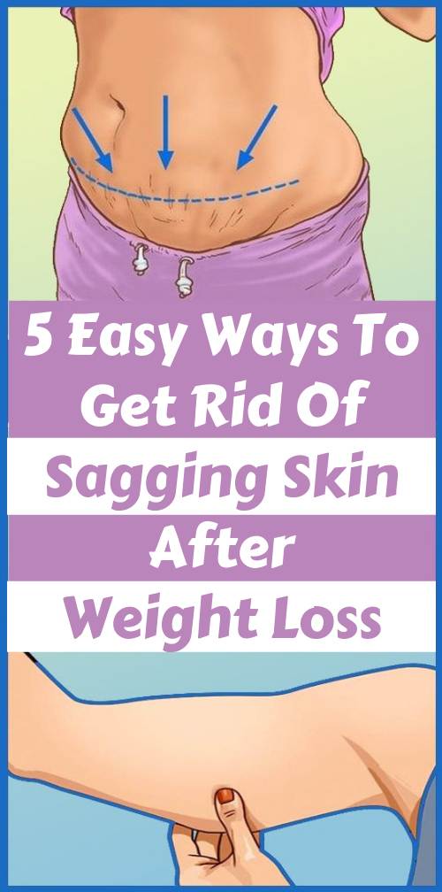 how to keep skin from sagging while losing weight