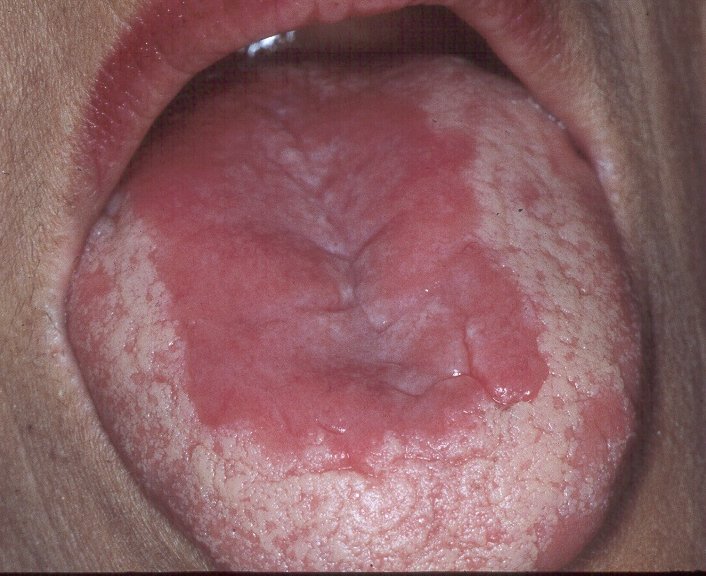 Natural Ways To Cure Yeast Infection In Dogs Natural Ways To Cure Yeast Infection In Dogs