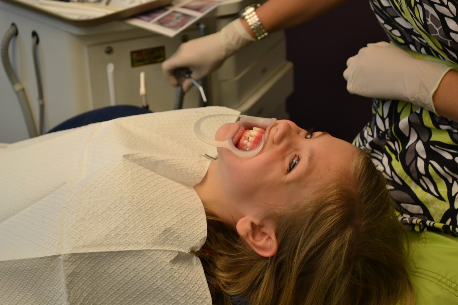 The Jackson Family Braces!!