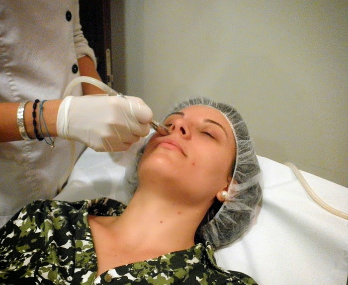 microdermoabrasión, punta de diamante, clinicas DH, Castellón