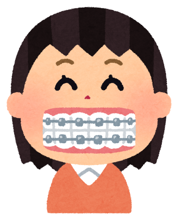 歯の矯正のイラスト（女性） | かわいいフリー素材集 いらすとや