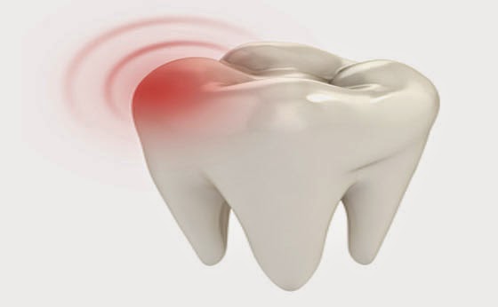 Les causes de maux de dents