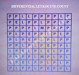 fill DIFFERENTIAL LEUKOCYTE COUNT  in table