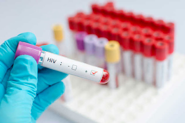 12.000 Plasma Darah asal China Positif Terkena Virus HIV 12.000 Plasma Darah asal China Positif Terkena Virus HIV