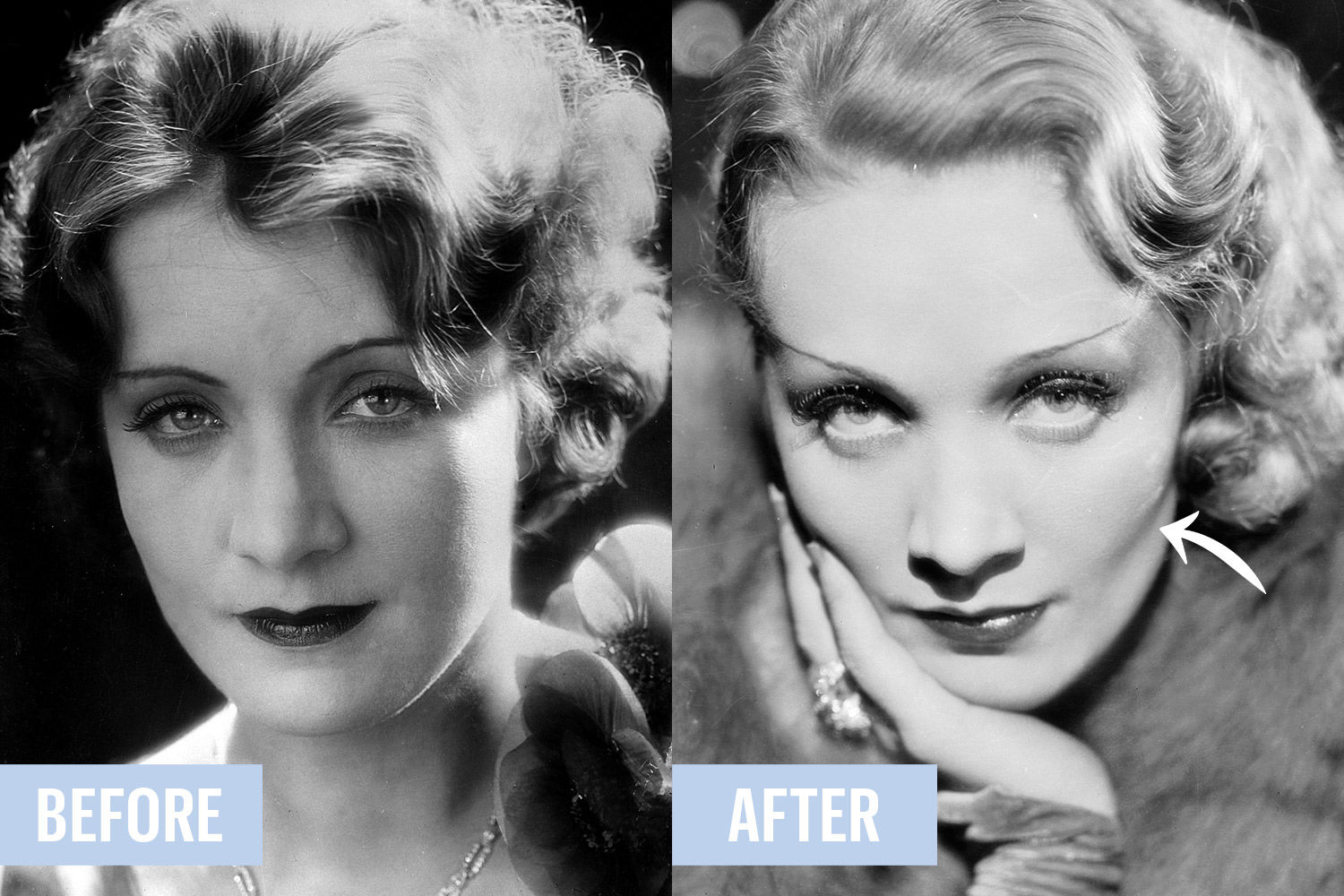 Beauty secrets, which are silent plastic surgeons Beauty secrets, which are silent plastic surgeons