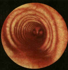 Spitz alemao respiracao ofegante Clearance