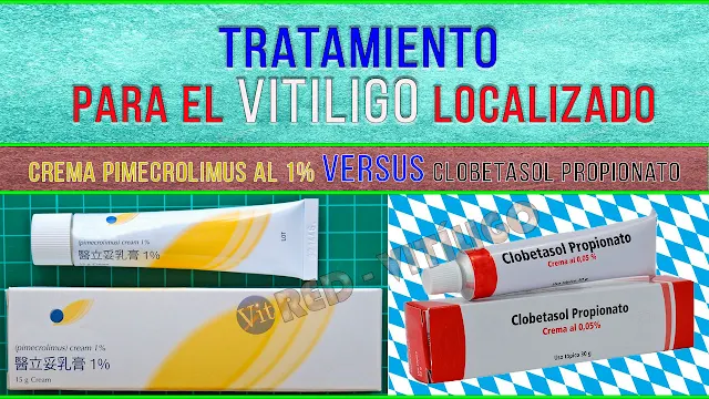 Tratamiento del Vitiligo localizado con Pimecrolimus topico en crema al 1% versus Crema de Clobetasol Propionato al 0.05%