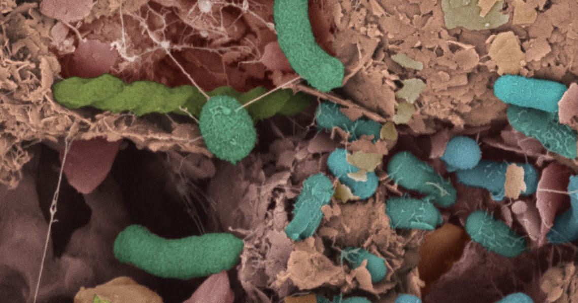 Of Bacteria and Men A view of microbial life in soil