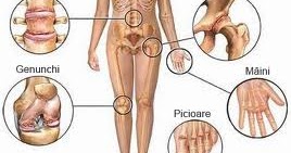 Dureri articulare (pe fond reumatic) - tratament homeopat : Homeopatie | Boli si tratamente