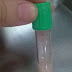 Sức khỏe: Bác sĩ “choáng” với ống máu xét nghiệm của bệnh nhân chiếm một nửa là mỡ