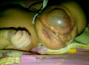 Alamat Muhammad bayi yang terkena kanker bayi bernama muhammad