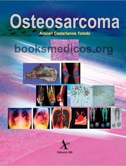 Osteosarcoma Castellanos pdf