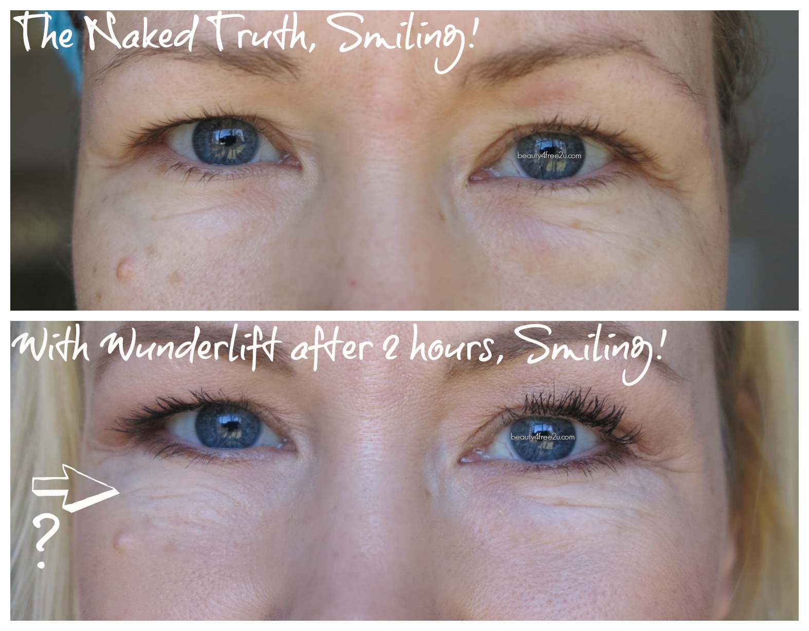 WUNDERLIFT 60 Second Wrinkle Reducer Review & BEFORE/AFTER PICTURES!