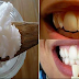 Remove Tartar and Plaque Permanently Using A Very Cheap Ingredient