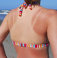 rimedi pelle abbronzata trattamenti per pelle abbronzata