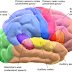 What is Brain Hemorrhage?