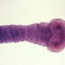 BREAKING: CNN – WORMS CAN INVADE YOUR BRAIN FROM EATING THIS COMMON FOOD