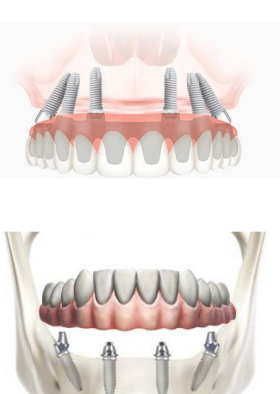 odontoiatri