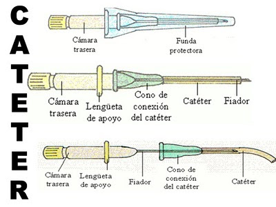 Cateter CONOCIMIENTOS BÁSICOS - NURSING: VENOCLISIS - CATETERISMO PERIFÉRICA