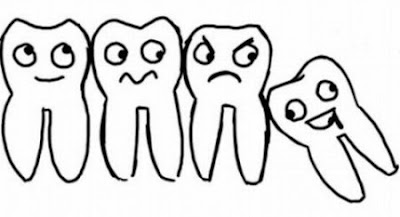 Khi bị đau do mọc răng khôn nên làm gì?